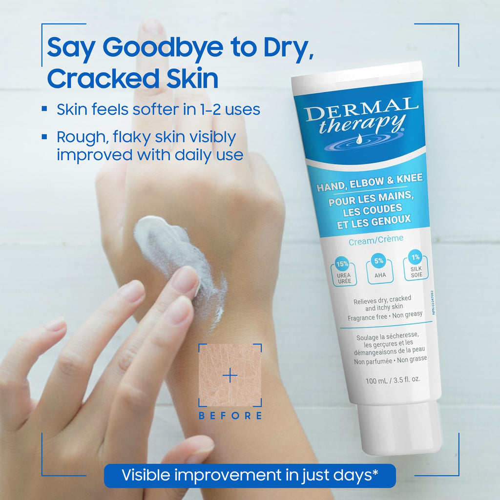 Dermal Therapy Hand Elbow & Knee Cream with 15% Urea and 6% AHA – Hydrating and Exfoliating Cream for Dry and Rough Skin, Fragrance Free Non Greasy Formula for Hands Elbows Knees and Feet, 3.5 fl oz